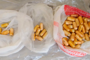 Argentina: boliviano huye del hospital tras costosa cirugía por ingestión de cápsulas de cocaína
