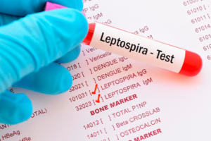 SEDES Confirma Dos Casos de Leptospirosis en Caraparí